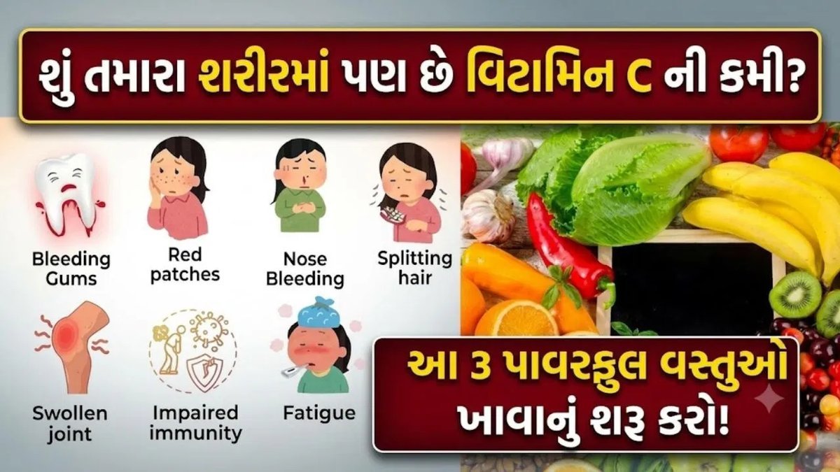 વિટામિન C ની ઉણપ પૂરવા આ 3 સુપરફૂડ્સ, સંતરા કરતાં 20 ગણું વધુ વિટામિન C