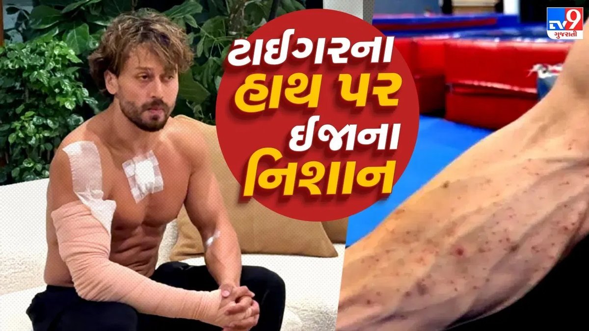 ગોળીબારમાં ટાઈગર શ્રોફના હાથ પર ઈજા, ગનપાઉડર અને કાચની અસર; માતાએ તસવીર શેર કરી