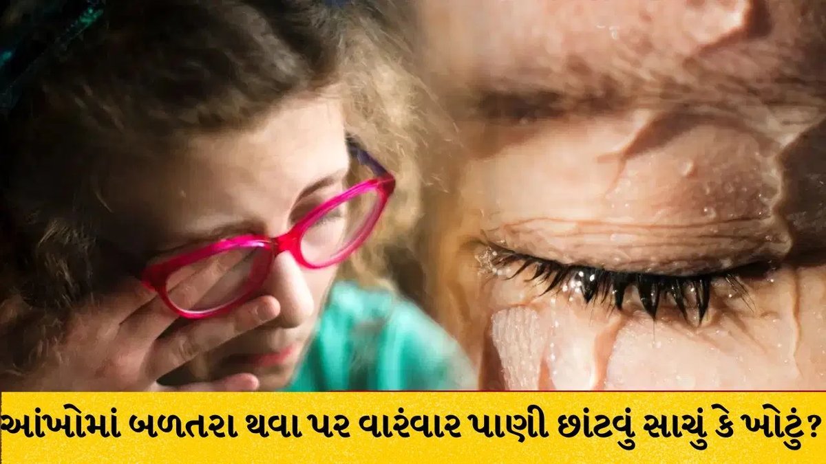 આંખોમાં બળતરા થાય ત્યારે પાણી છાંટવું યોગ્ય છે કે નહીં? જાણો ડૉક્ટરની સલાહ