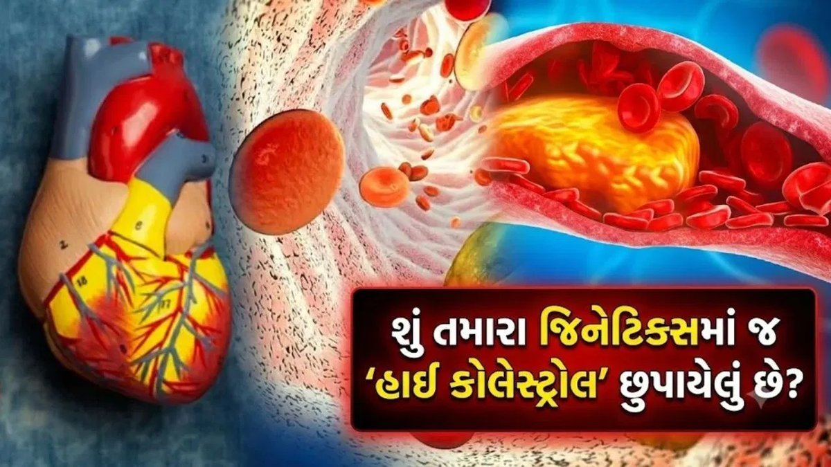 ઊંચા કોલેસ્ટ્રોલનું જોખમ જિનેટિક્સમાં પણ સારા આહારથી ઘટી શકે: અભ્યાસ