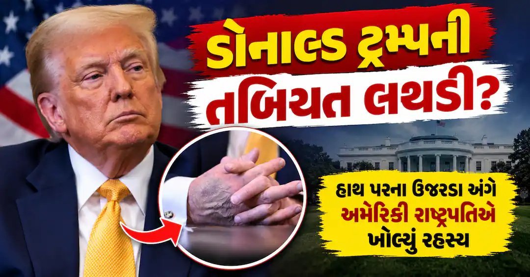 ટ્રમ્પના હાથ પરના ઉઝરડા પાછળનું કારણ શું? રાષ્ટ્રપતિએ એસ્પિરિન લેવાનો ખુલાસો કર્યો