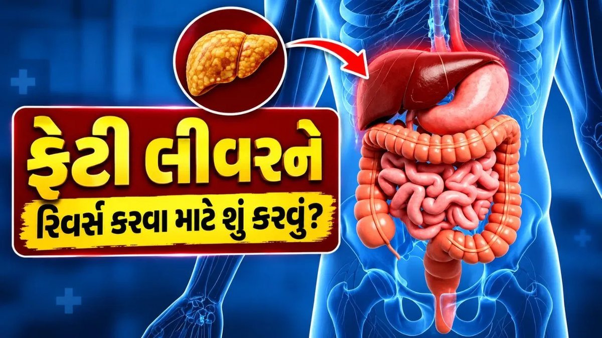ફેટી લીવરને રિવર્સ કરવા માટે ડૉક્ટરે જણાવી સરળ રીતો, જાણો શું કરવું