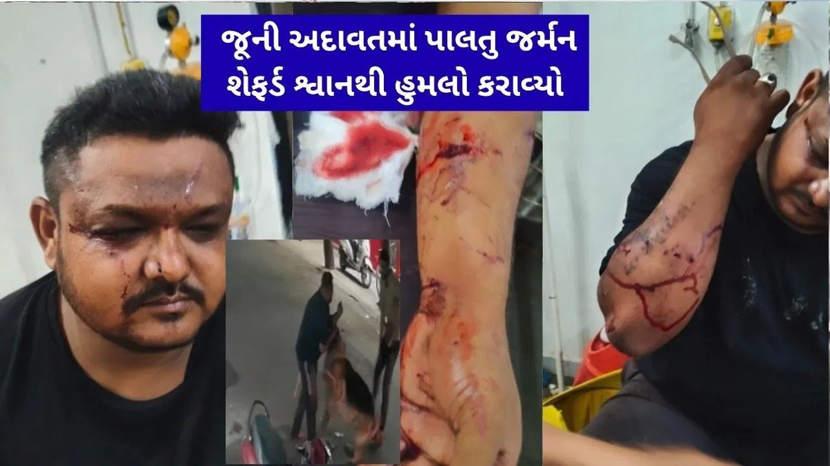 રાજકોટમાં જૂની અદાવતમાં પાલતુ કૂતરાથી હુમલો, યુવાન ગંભીર ઇજાગ્રસ્ત