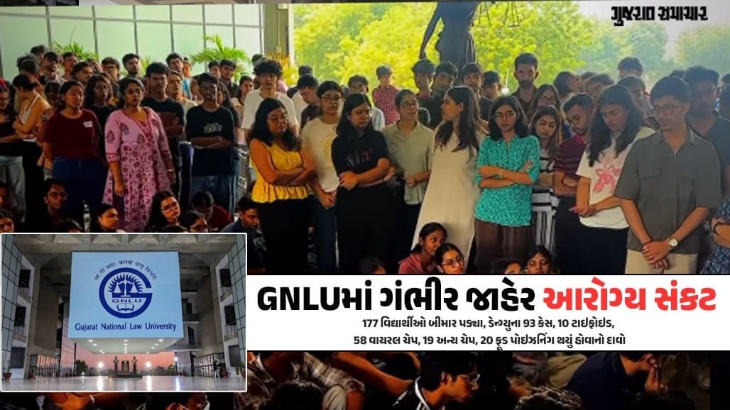 GNLUમાં સ્વાસ્થ્ય સંકટ: હોસ્ટેલમાં 177 વિદ્યાર્થીઓ બીમાર, ડેન્ગ્યુના 93 કેસ