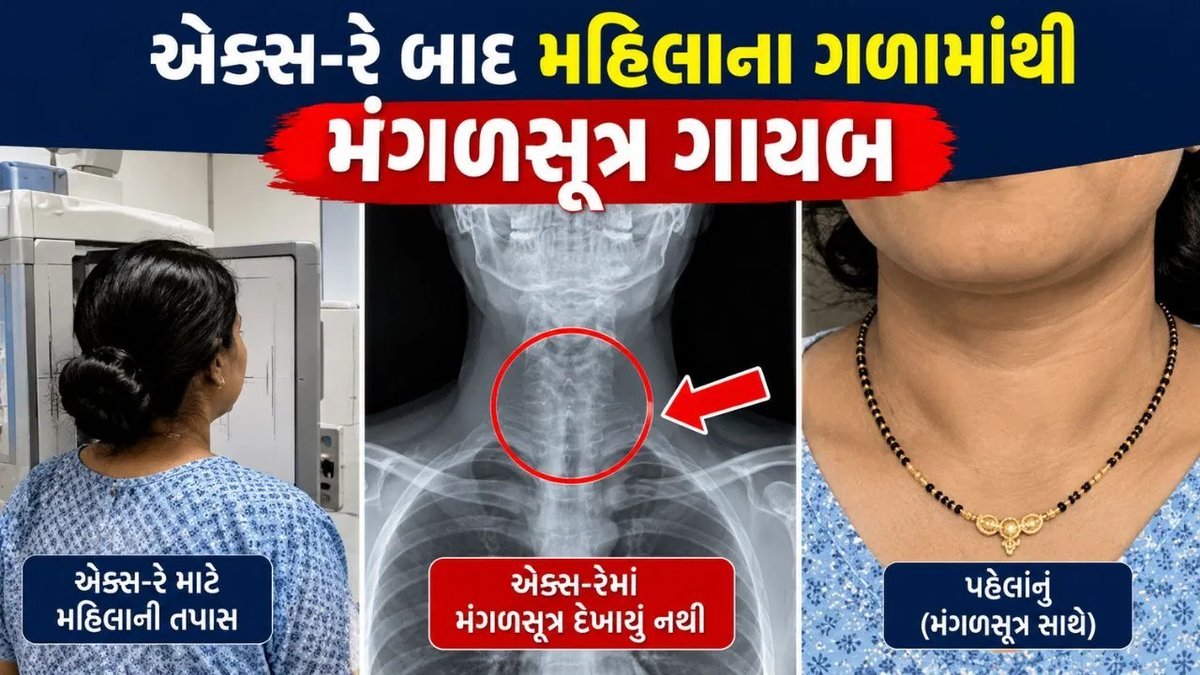 સુરત: X-રે બાદ મહિલાના ગળામાંથી મંગળસૂત્ર ગાયબ, પરિવારનો હોબાળો